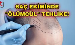 Saç Ekiminde "Ölümcül" Tehlike!