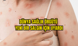 DSÖ MAYMUN ÇİÇEĞİ VİRÜSÜ İLE İLGİLİ UYARDI