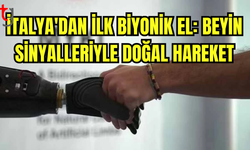 DÜŞÜNCE GÜCÜYLE HAREKET EDEN BİYONİK EL MİLYONLARCA İNSANA UMUT SAĞLAYACAK