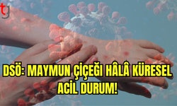 DSÖ: Maymun Çiçeği Hâlâ Küresel Acil Durum