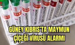 Güney Kıbrıs'ta maymun çiçeği virüsü alarmı