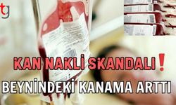 Kan nakli skandalı! Beynindeki kanama arttı