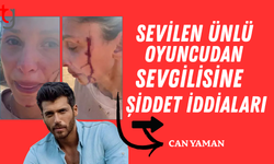Can Yaman'ın sevgilisi Sara Bluma şiddet gördüğünü açıkladı