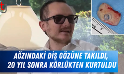 Ağzındaki diş gözüne takıldı, 20 yıl sonra körlükten kurtuldu