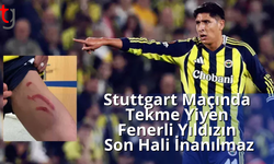 Stuttgart maçında tekme yiyen Fenerli yıldızın son hali inanılmaz