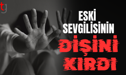 Gazimağusa’da kıskançlık kavgası: Genç kadının dişi kırıldı