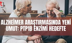 Alzheimer tedavisinde kombinasyon terapisi gündemde