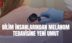 Melanomun büyümesini tetikleyen molekül keşfedildi