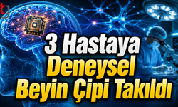 3 Hastaya Deneysel Beyin Çipi Takıldı