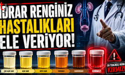 İdrar renginiz hastalıkları ele veriyor! En tehlikeli renk açıklandı