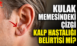 Kulak Memesindeki Çizgi Kalp Hastalığı Belirtisi mi?