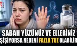 SABAH YÜZÜNÜZ VE ELLERİNİZ ŞİŞİYORSA NEDENİ FAZLA TUZ OLABİLİR
