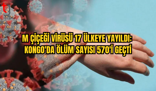 M Çiçeği Virüsü 17 Ülkeye Yayıldı: Kongo Demokratik Cumhuriyeti'nde Ölümler Artıyor