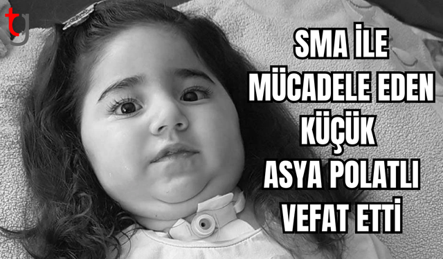 SMA HASTASI ASYA BEBEK YAŞAMA VEDA ETTİ!