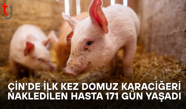 Çin’de İlk Kez Domuz Karaciğeri Nakledilen Hasta 171 Gün Yaşadı