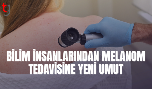 Melanomun büyümesini tetikleyen molekül keşfedildi
