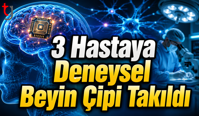 3 Hastaya Deneysel Beyin Çipi Takıldı