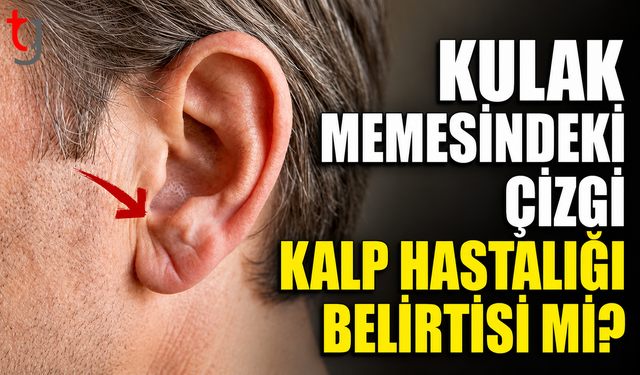 Kulak Memesindeki Çizgi Kalp Hastalığı Belirtisi mi?