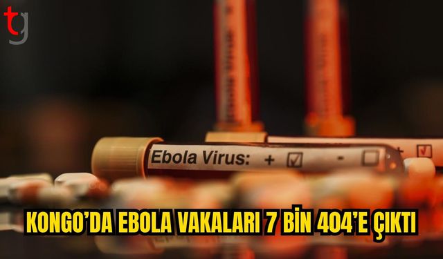 Kongo’da Ebola vakaları 7 bin 404’e yükseldi