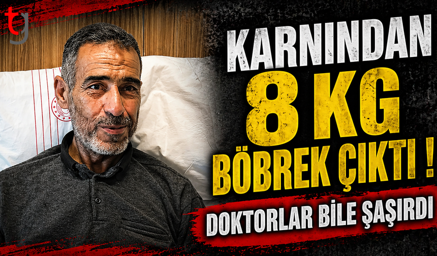 Karnından 8 kiloluk böbrek çıktı! Doktorlar bile şaşırdı